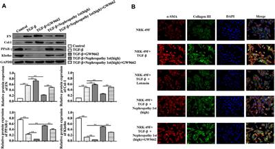 Nephropathy 1st inhibits renal fibrosis by activating the PPARγ signaling pathway